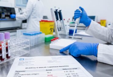 Prikaz analize tumor markera